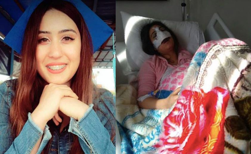 Mietet Ta’ 24 Sena Wara Li Għamlet Plastic Surgery Fl-Imnieħer