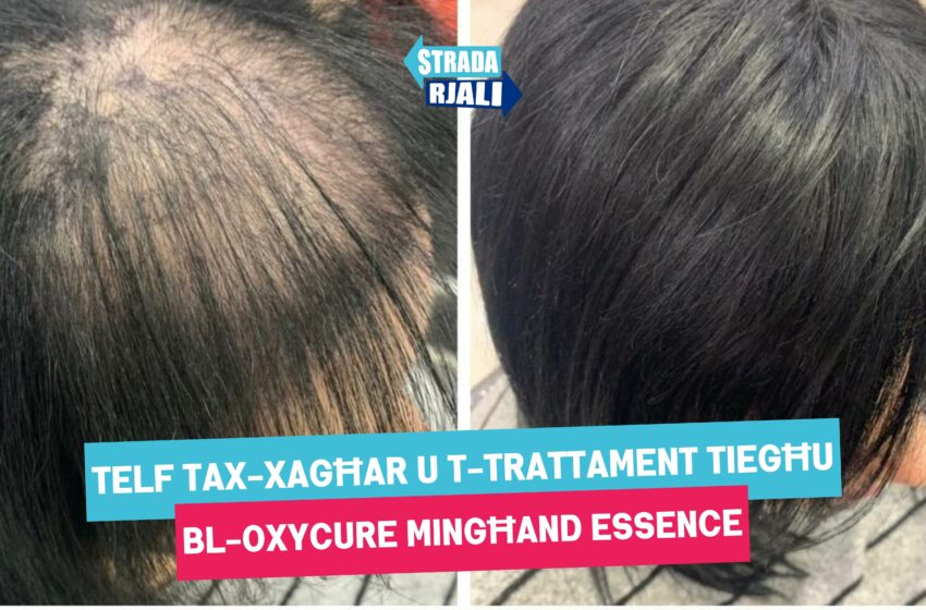  Telf tax-xagħar, il-prevenzjoni u t-trattament tiegħu